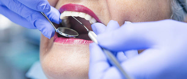 Best Emergency Dental Extractions in Richwood, NJ